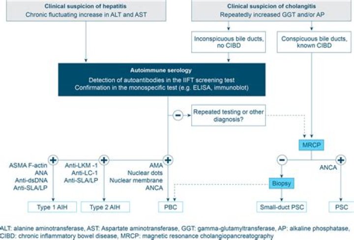 Comprehensive Guide to Autoimmune Liver Disease Care Near La Grange