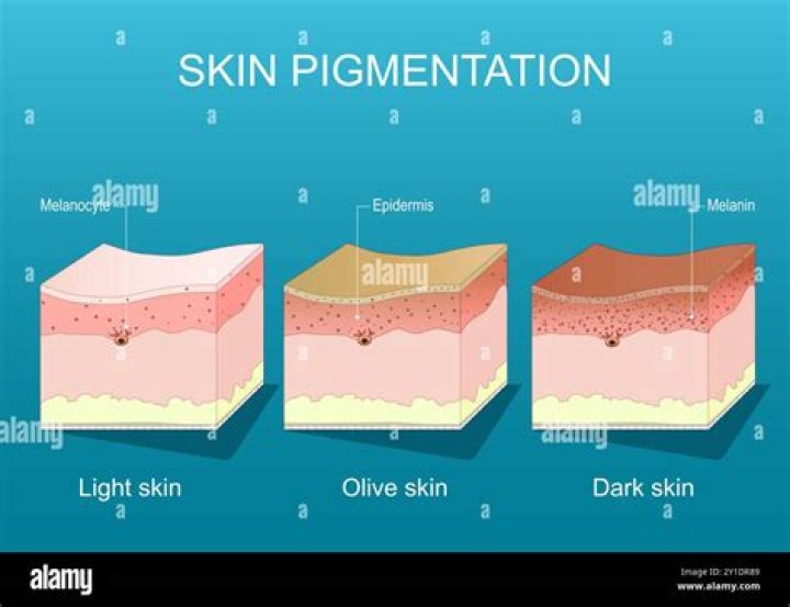 Discovering the Whitest Person on Earth: Unveiling the Secrets of Human Skin Pigmentation