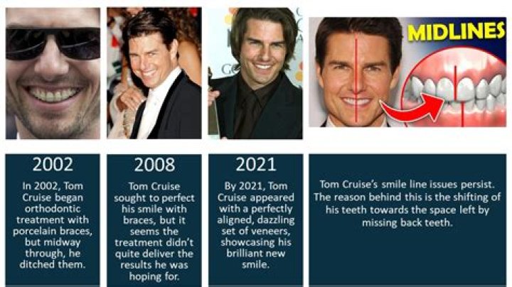 Exploring the Iconic Smile of Tom Cruise: The Middle Tooth Phenomenon