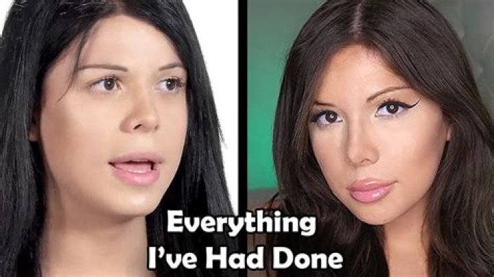 Has Blaire White Had Surgery? A Comprehensive Look into Her Transformation