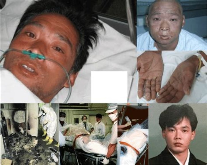 Understanding the Graphic Photos of Hisashi Ouchi: A Deep Dive into a Tragic Incident