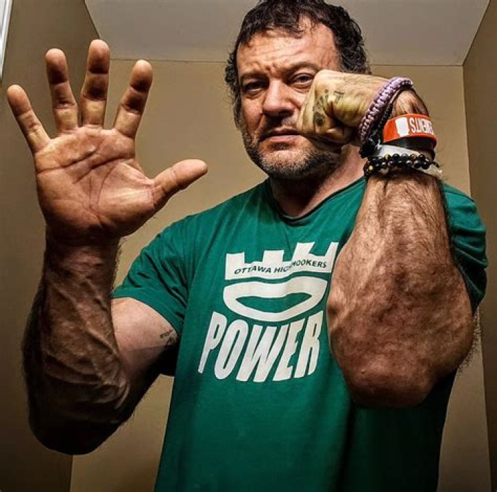 Unraveling the Strength and Spirit of Devon Larratt