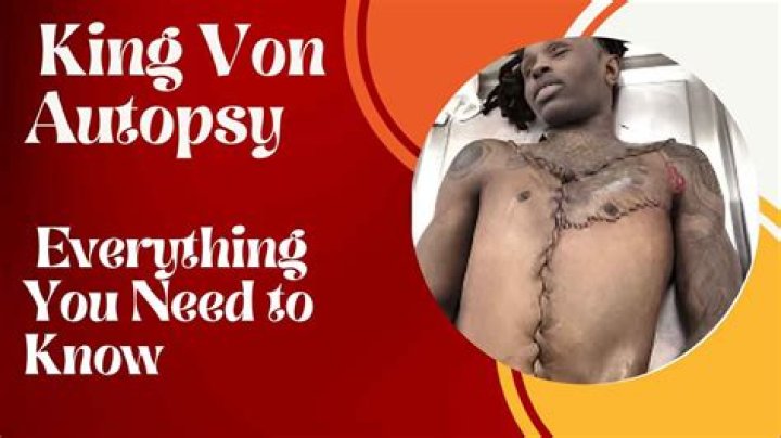 Unveiling the Truth: King Von Autopsy Pictures and the Mystery Surrounding His Death