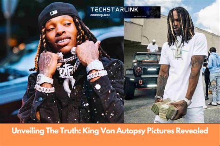 Unveiling the Truth: King Von Autopsy Pictures